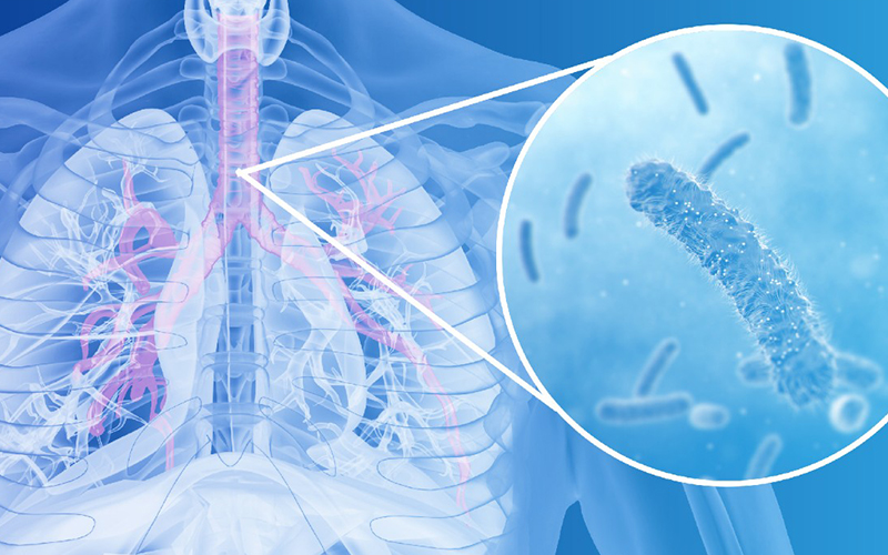 MTB/NTM Rapid Detection Solution